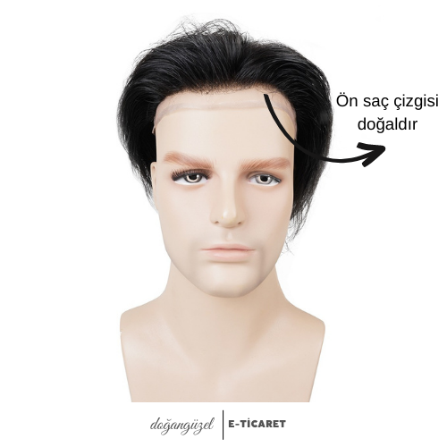 Style Hair Hollywood Mono Protez Saç Sistemi ikinci görsel